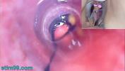 Video Bokep Mature Woman Peehole Endoscope Camera in Bladder with Balls hot