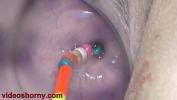 Download Video Bokep Uterus Penetration with Objects comma Pumping Cervix Prolapse gratis