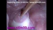 Link Bokep Insertion Semen Cum in Cervix Wide Stretching Pussy Speculum