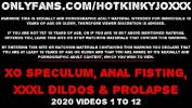 Nonton Bokep Hotkinkyjo XO speculum prolapse deep dildo belly bulge anal fisting amp extreme insertions onlyfans mp4