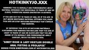 Bokep Video Double anal fisting amp prolapse by Sindy Rose amp Lady Kestler mp4
