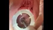 Bokep HD Painful cervix 8mm sound gratis