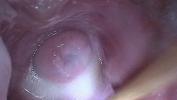 Download vidio Bokep Insertion Semen Cum in Cervix Wide Stretching Pussy Speculum 3gp