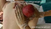 Download Video Bokep HKJ and DGG elbow deep anal fisting and belly bulge terbaru