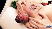 Download vidio Bokep Insanely Huge Prolapse excl Cervix Exposure period Eggplant Penetratio online