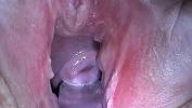 Video Bokep Cum Injection with Syringe in Cervix Utherus after Fucking 2020