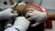 Bokep Full Medicos removem dildo preso no cu de mulher mp4