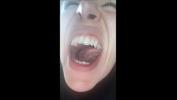 Bokep HD i need a dentist right now excl 3gp online